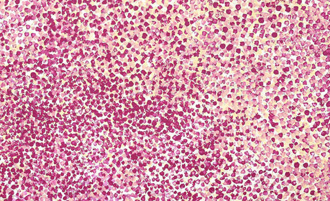 Bush Flowers and Plum | 153cm x 91cm | TJP 1401-1